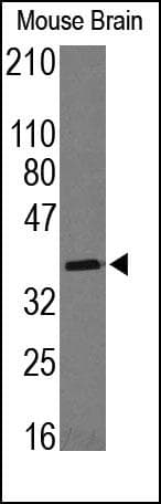 MTNR1A / Melatonin Receptor 1a Antibody