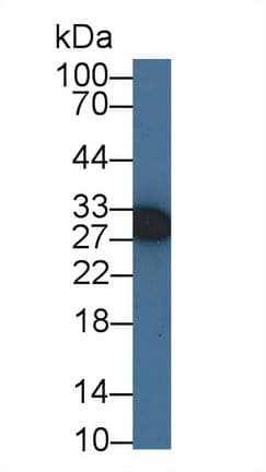 IGFBP3 Antibody (aa140-271)