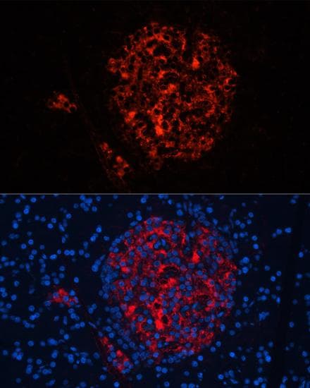 Insulin Antibody