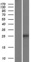Human TMEM136 Protein (Over-Expression Lysate Myc-DDK (Flag))