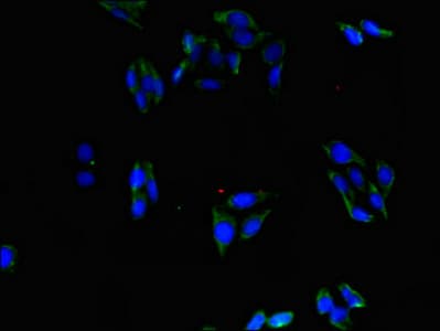 Polyclonal Rabbit anti-Human ABLIM1 Antibody (IHC, IF, WB)