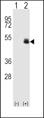 Polyclonal Rabbit anti-Human PAX6 Antibody (aa352-380, IHC, IF, WB)