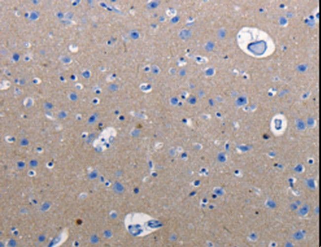 RAB3C Antibody