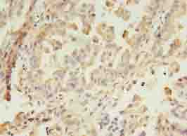 GIT2 Antibody
