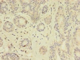 TK1 / TK / Thymidine Kinase Antibody (aa2-234)