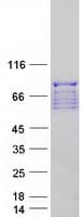 Human PKP3 / Plakophilin 3 Protein (Recombinant Myc-DDK (Flag))