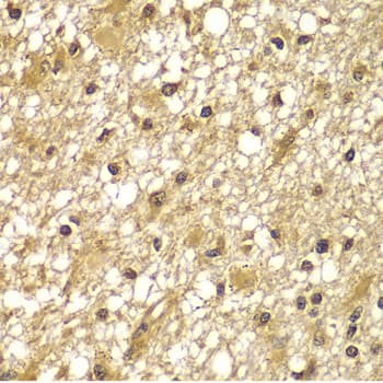PIK3R3 / p85 Gamma Antibody