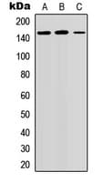 Polyclonal Rabbit anti-Human GPR158 Antibody (N-Terminus, WB)