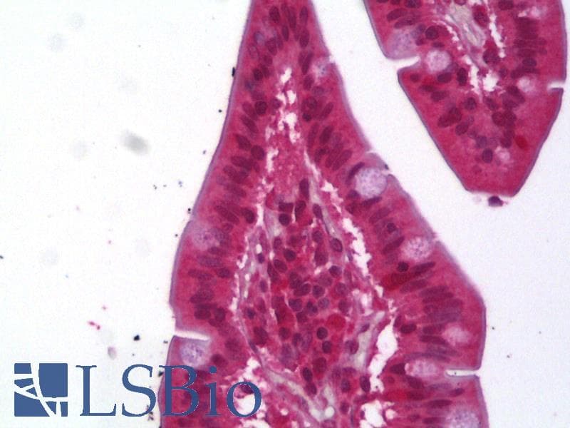 IHC-plus™ Polyclonal Rabbit anti-Human ACAT1 Antibody (IHC, WB)