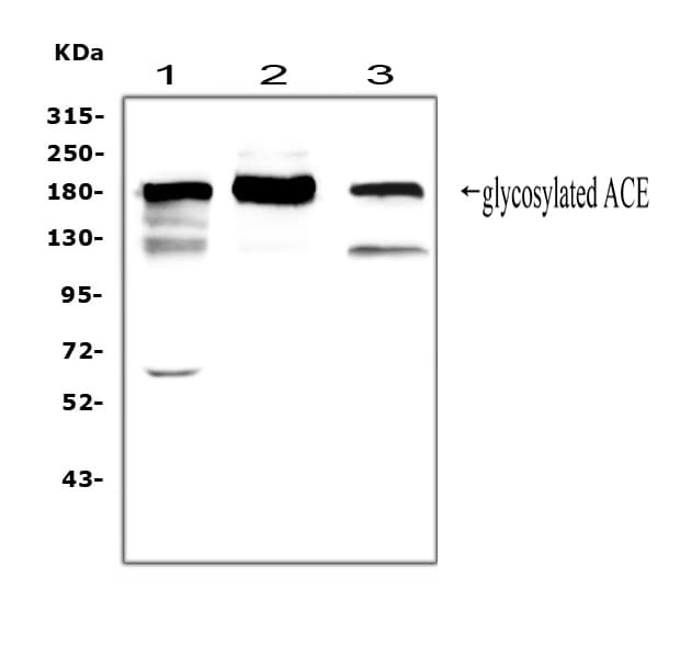 ACE / CD143 Antibody (aa651-864)