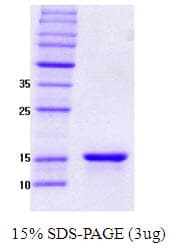 Human SNCG / Gamma-Synuclein Protein (Recombinant)