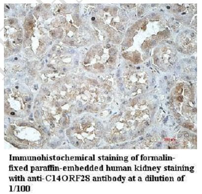 DRIP1 / C14orf28 Antibody