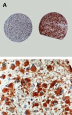 Polyclonal Rabbit anti-Human CASP8 / Caspase 8 Antibody (IHC, WB)
