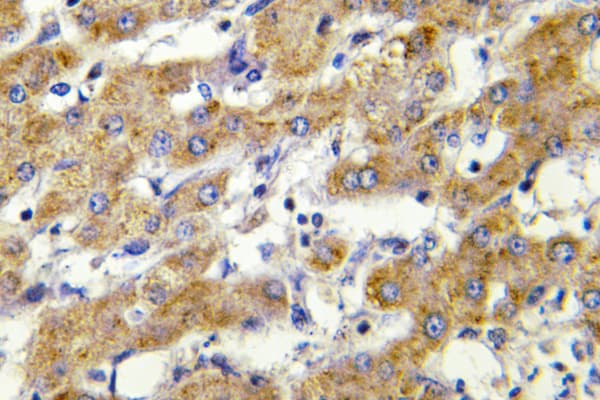 CYP2C8+9+18+19 Antibody (Met136)