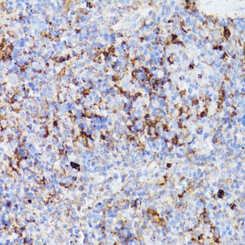 CD4 Antibody