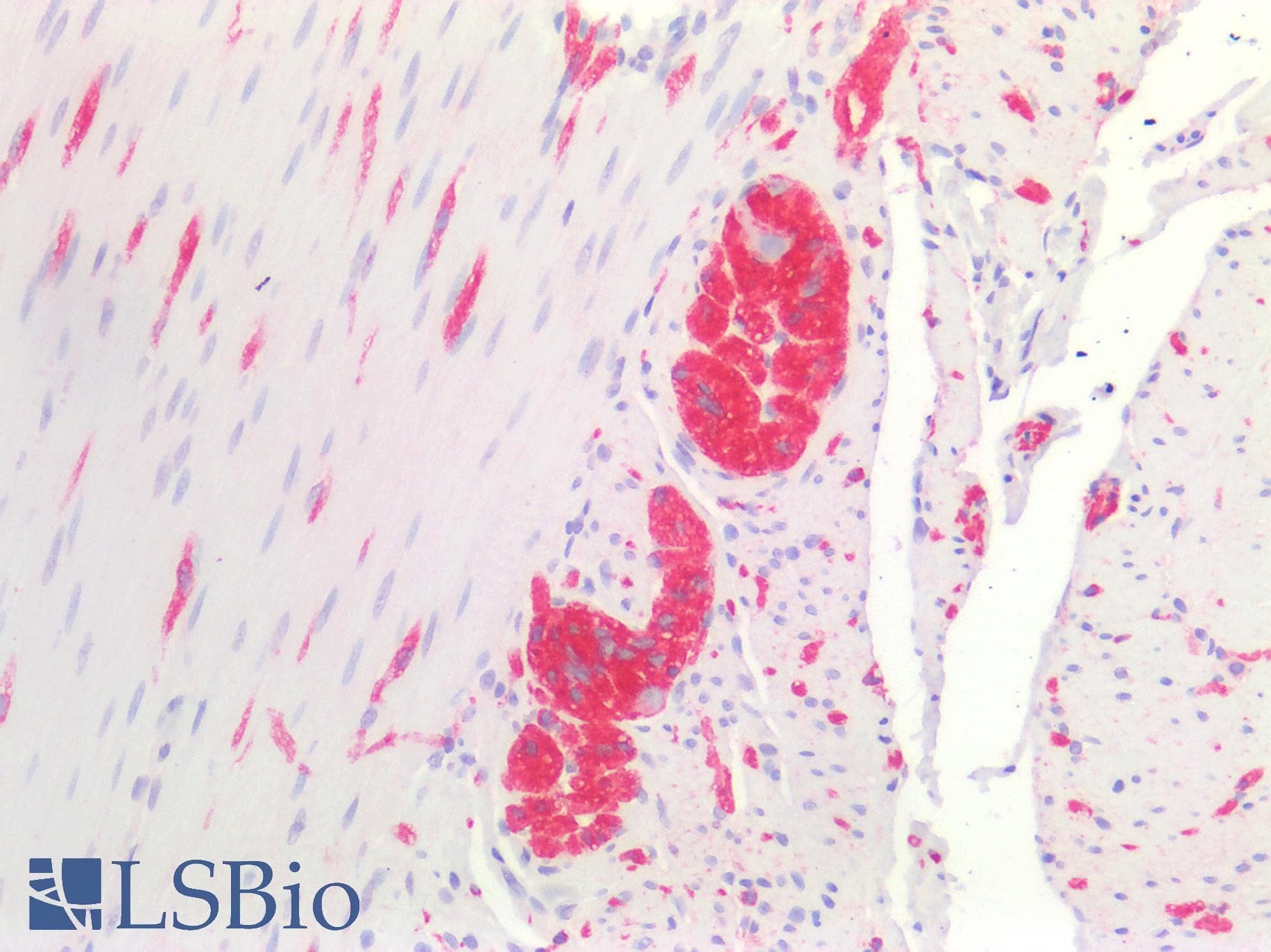 PathPlus™ NCAM / CD56 Antibody