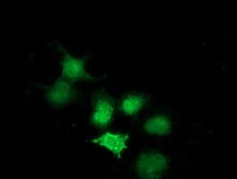SULT1A1 / Sulfotransferase 1A1 Antibody (clone OTI2C5)