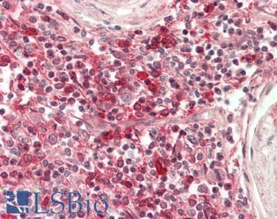 PathPlus™ Polyclonal Rabbit anti-Human HLA-DRA Antibody (IHC, WB)