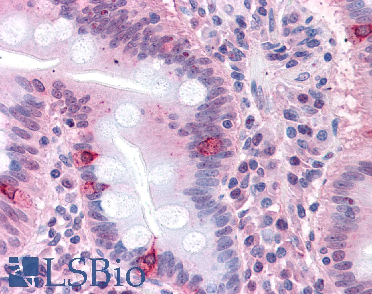 IHC-plus™ SEMA4B / Semaphorin 4B Antibody (Internal)