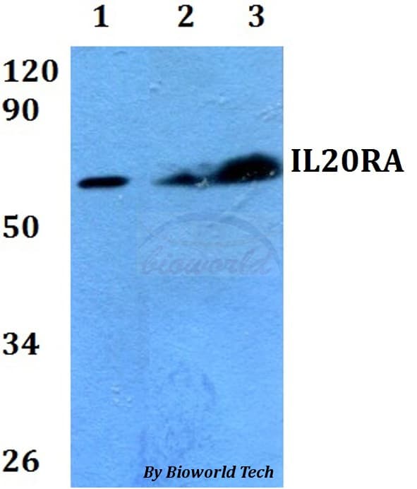 IL20RA Antibody