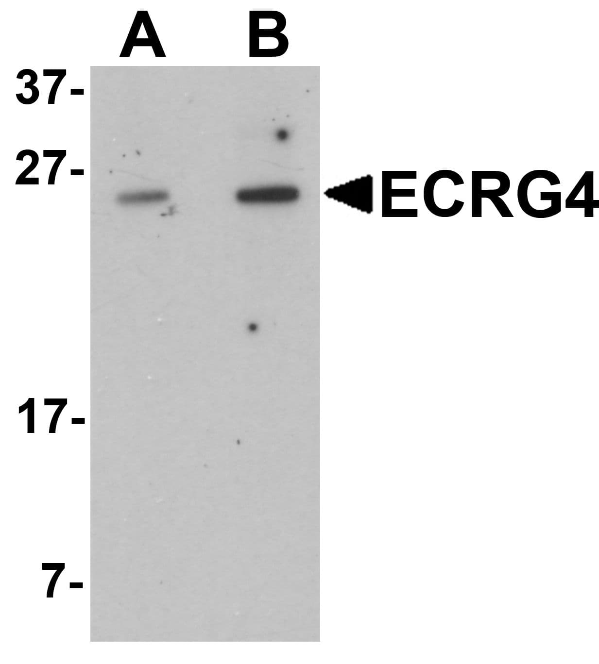 IHC-plus™ Polyclonal Rabbit anti-Human C2orf40 / ECRG4 Antibody (IHC, WB)