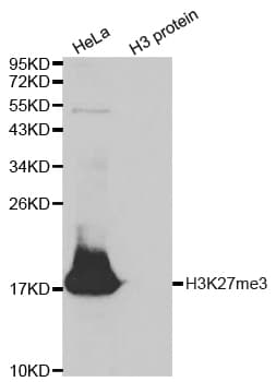 Histone H3 Antibody (Trimethyl-Lys27)