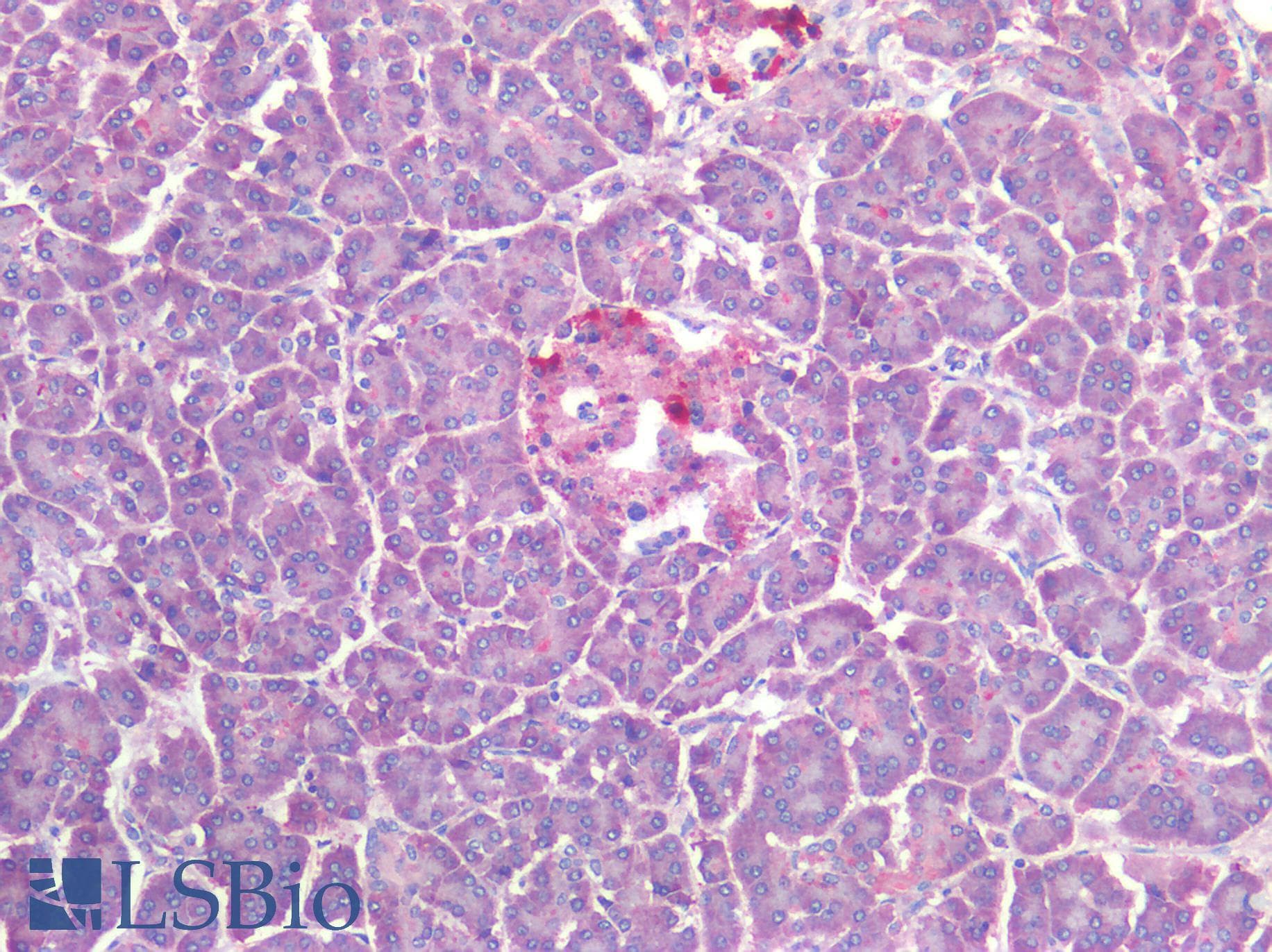 IHC-plus™ SST / Somatostatin Antibody