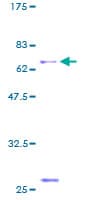 Human ACRV1/Intra-Acrosomal Protein (Recombinant GST)