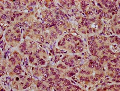 Polyclonal Rabbit anti-Human NOXO1 Antibody (IHC, IF)