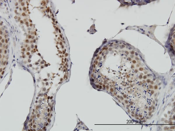 RNF141 Antibody (clone 6D9)