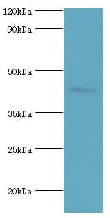 CD121b / IL1R2 Antibody (aa20-320)