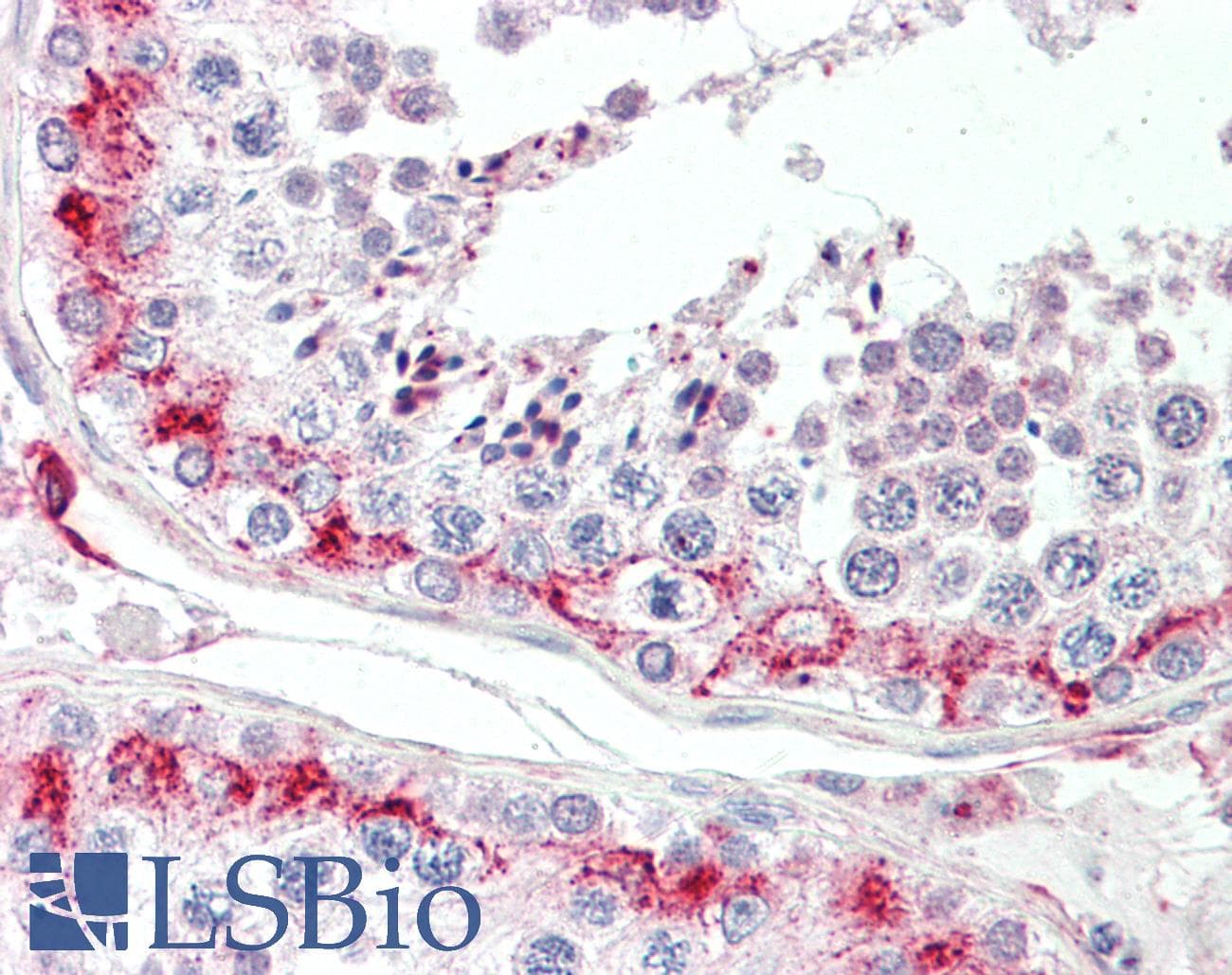 IHC-plus™ LYZL1 Antibody
