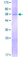 Human SIRT4 / Sirtuin 4 Protein (Recombinant GST)