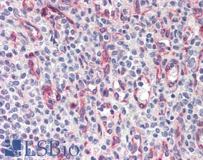 IHC-plus™ RCD1 / RQCD1 Antibody