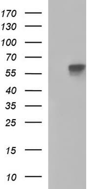 PLAP / Alkaline Phosphatase Antibody (clone OTI1H2)