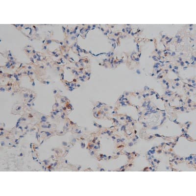 MAPT / Tau Antibody (phospho-Ser422)