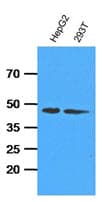 IHC-plus™ ADK / Adenosine Kinase Antibody (clone AT4F8)