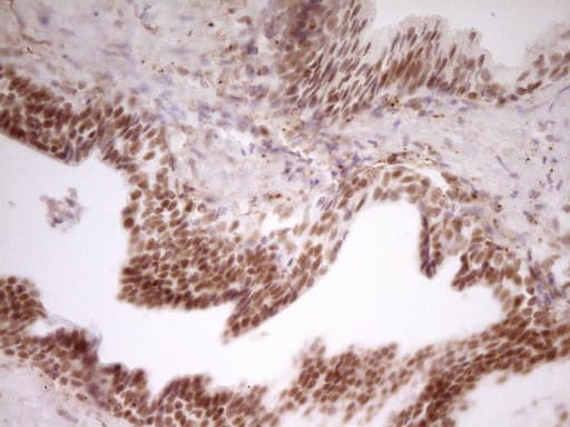 NR2C2 / TAK1 Antibody (aa1-241, clone OTI1F3)