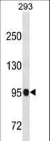 SFMBT1 Antibody (aa20-47)