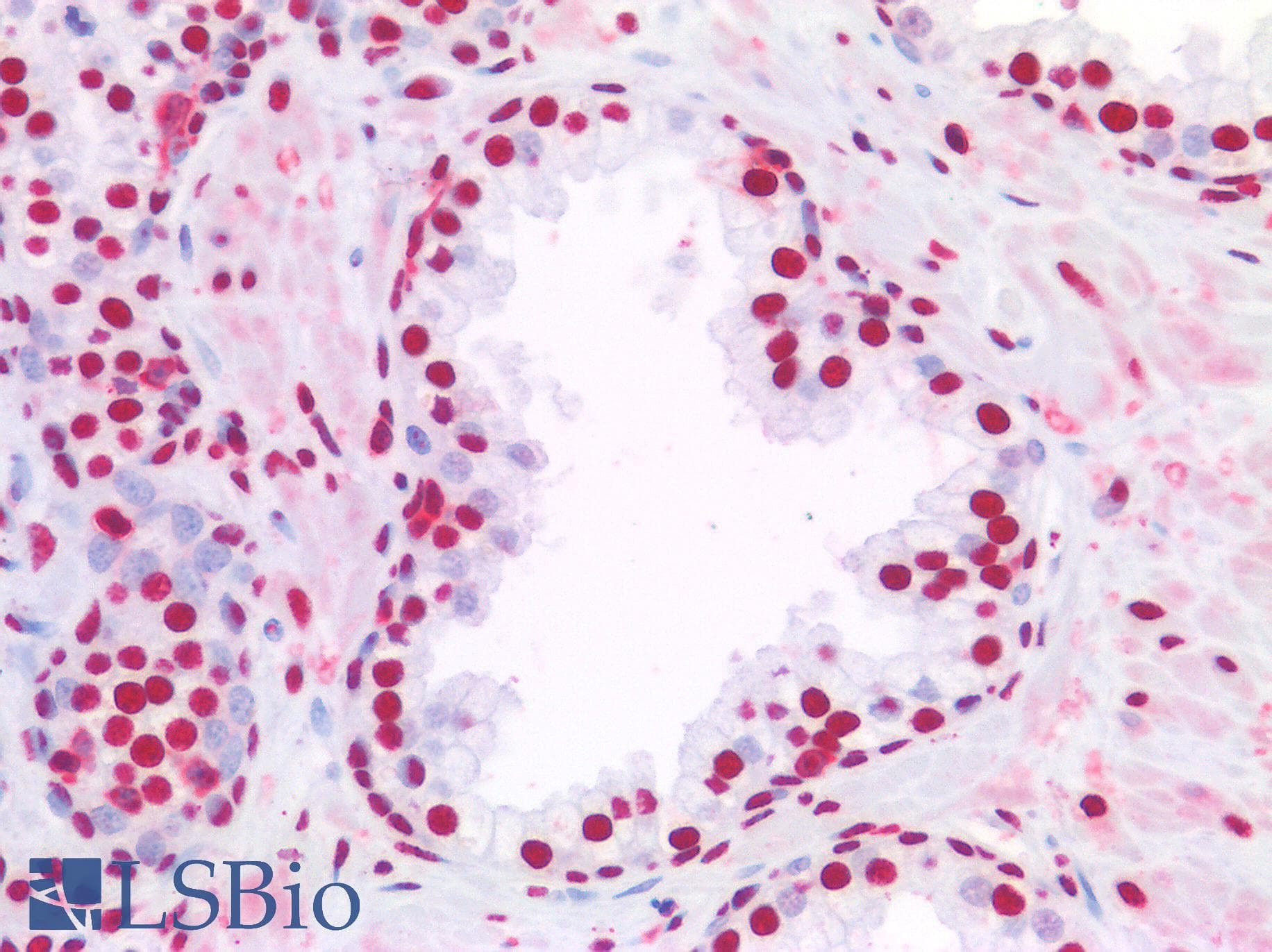PathPlus™ NALP3 / NLRP3 Antibody