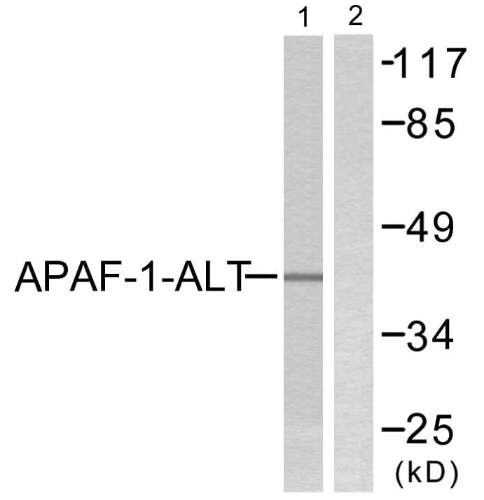 Polyclonal Rabbit anti-Human APIP Antibody (IHC, WB)
