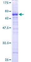 Human HPD Protein (Recombinant GST)