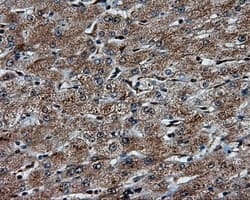 Monoclonal Mouse anti-Human PTPRE / PTP Epsilon Antibody (clone OTI4B2, IHC, IF, WB)