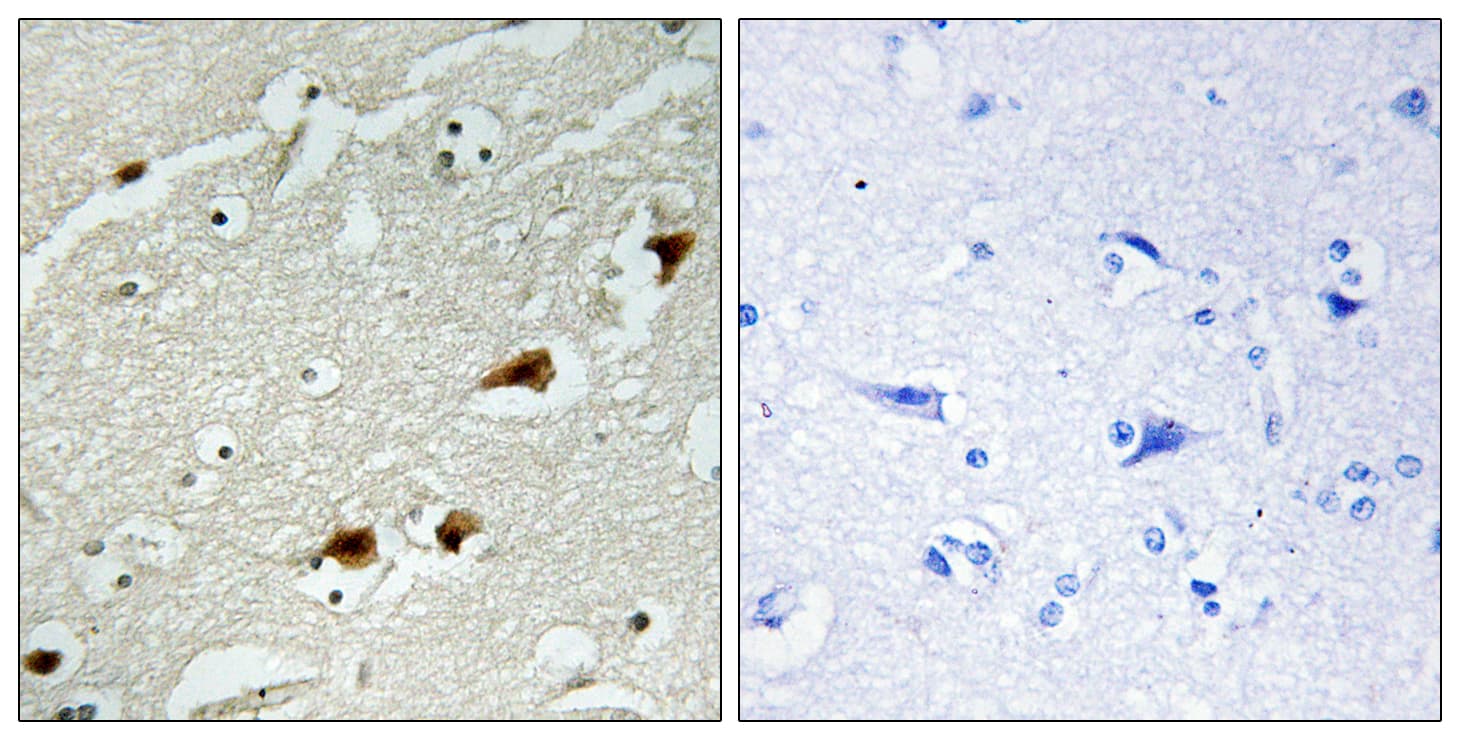 RELA / NFKB p65 Antibody (aa496-545)