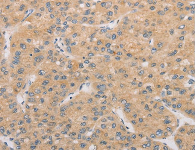 ATG4D Antibody