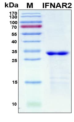 Human IFNAR2 Protein (Recombinant 6His, N-terminus)