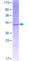 Human Ribonuclease A / RNASE1 Protein (Recombinant GST)