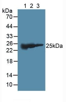 GSTM2 Antibody (aa3-218)