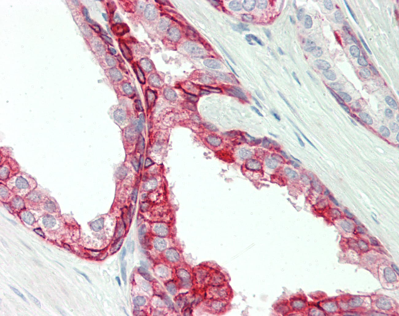 Polyclonal Rabbit anti-Human DPP4 / CD26 Antibody (aa663-712, IHC, WB)