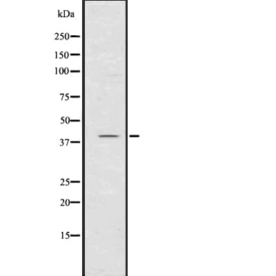 CXCR1 Antibody (aa1-22)